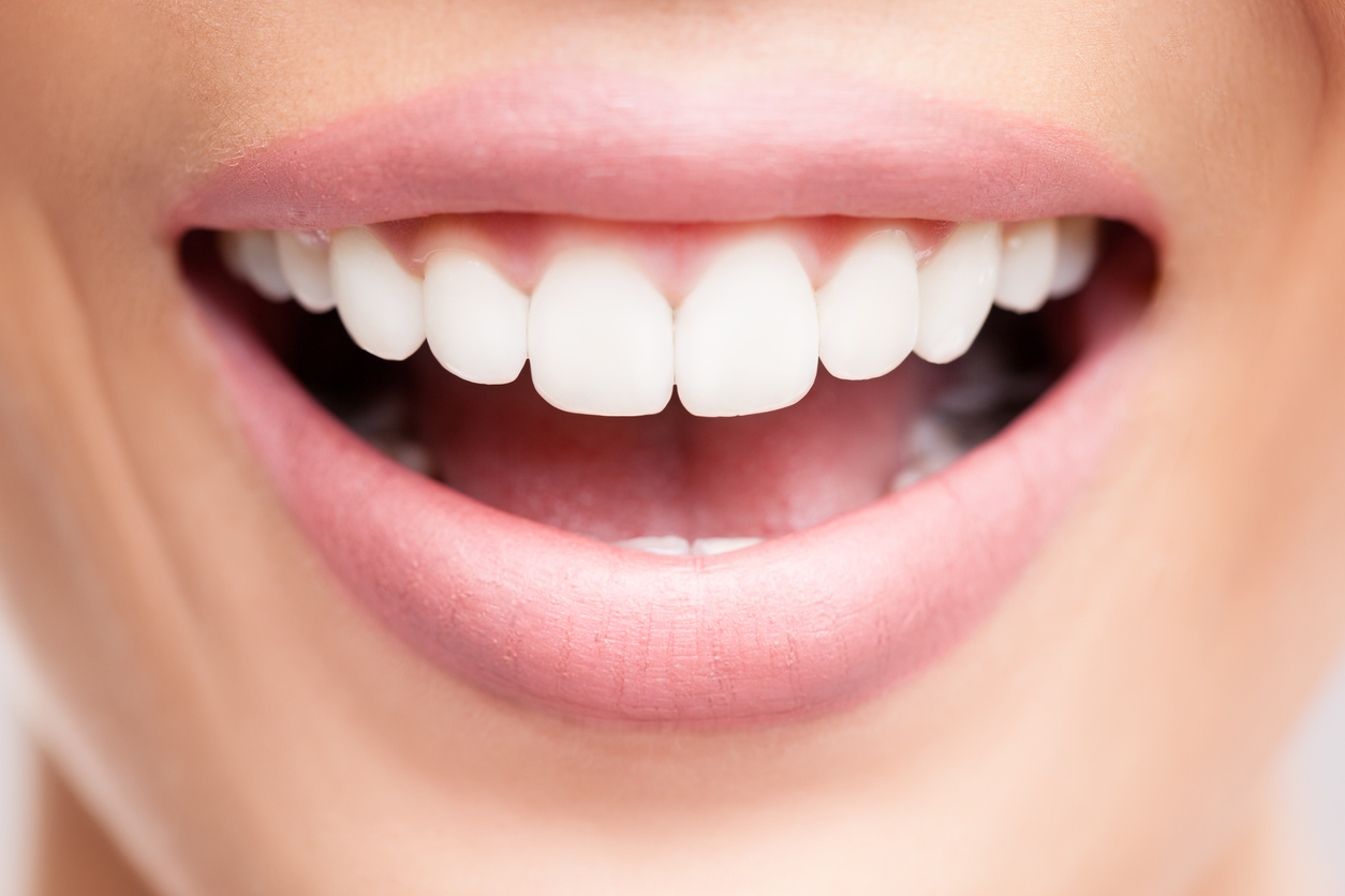 Dents blanches et sourire éclatant