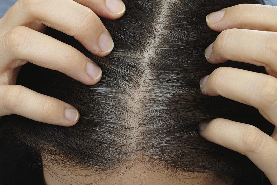 Cheveux gris et blancs mélangés