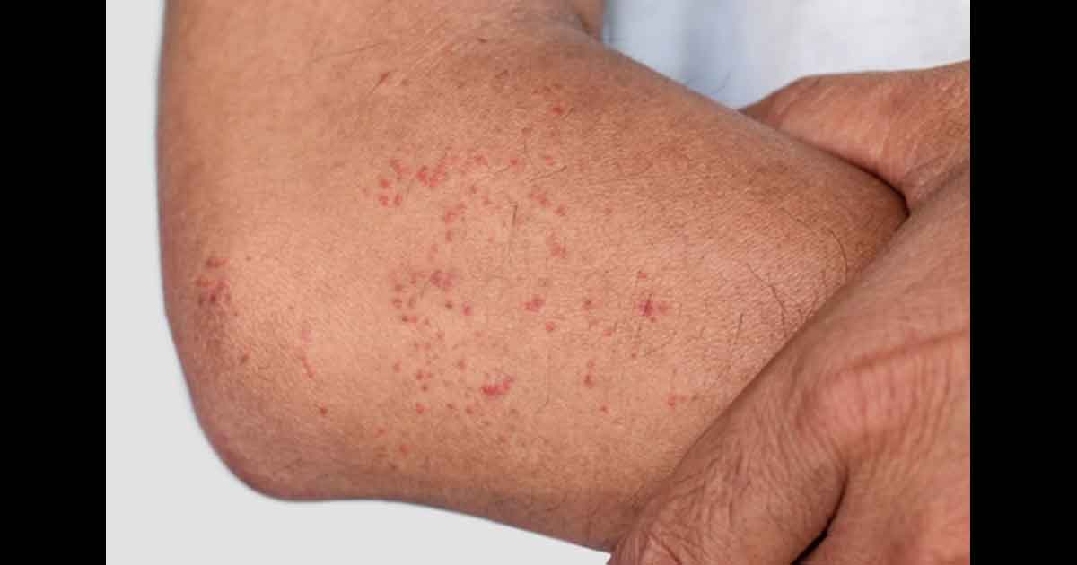 Femme examinant sa peau