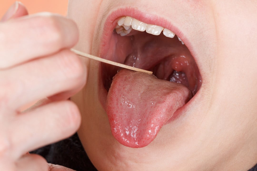 Techniques d'hygiène buccale