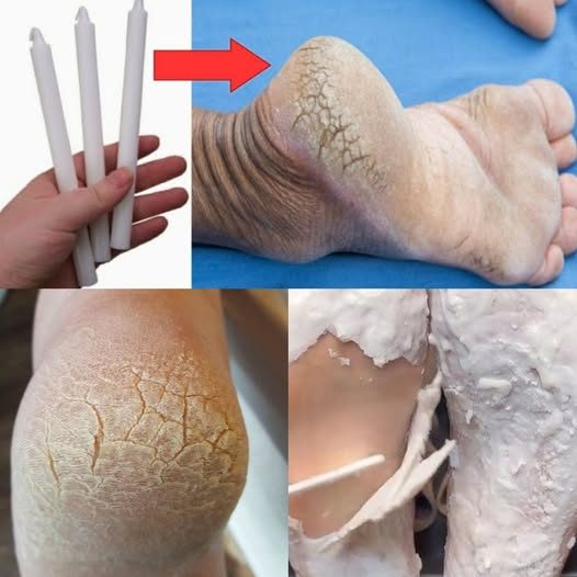 Une bougie et des pieds soyeux