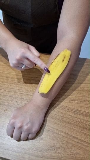 Peau de banane sur une piqûre