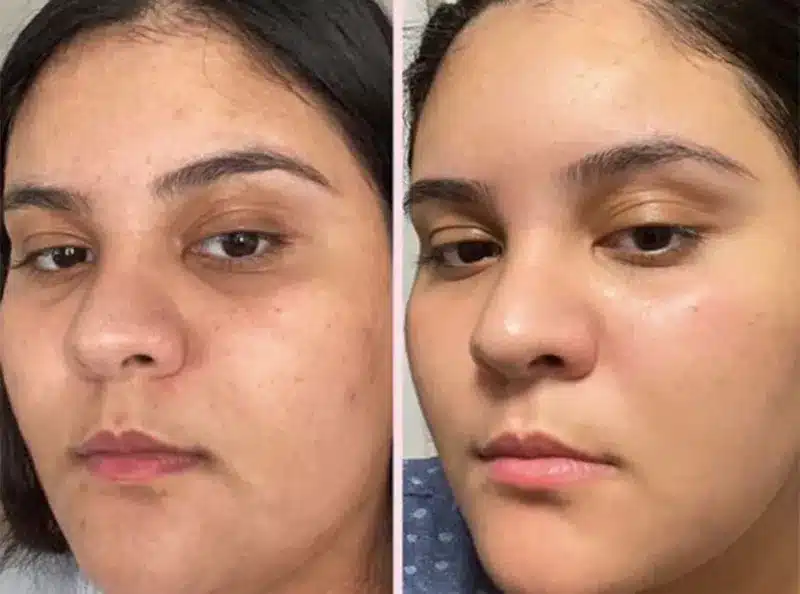 Soin visage naturel à base de plantes
