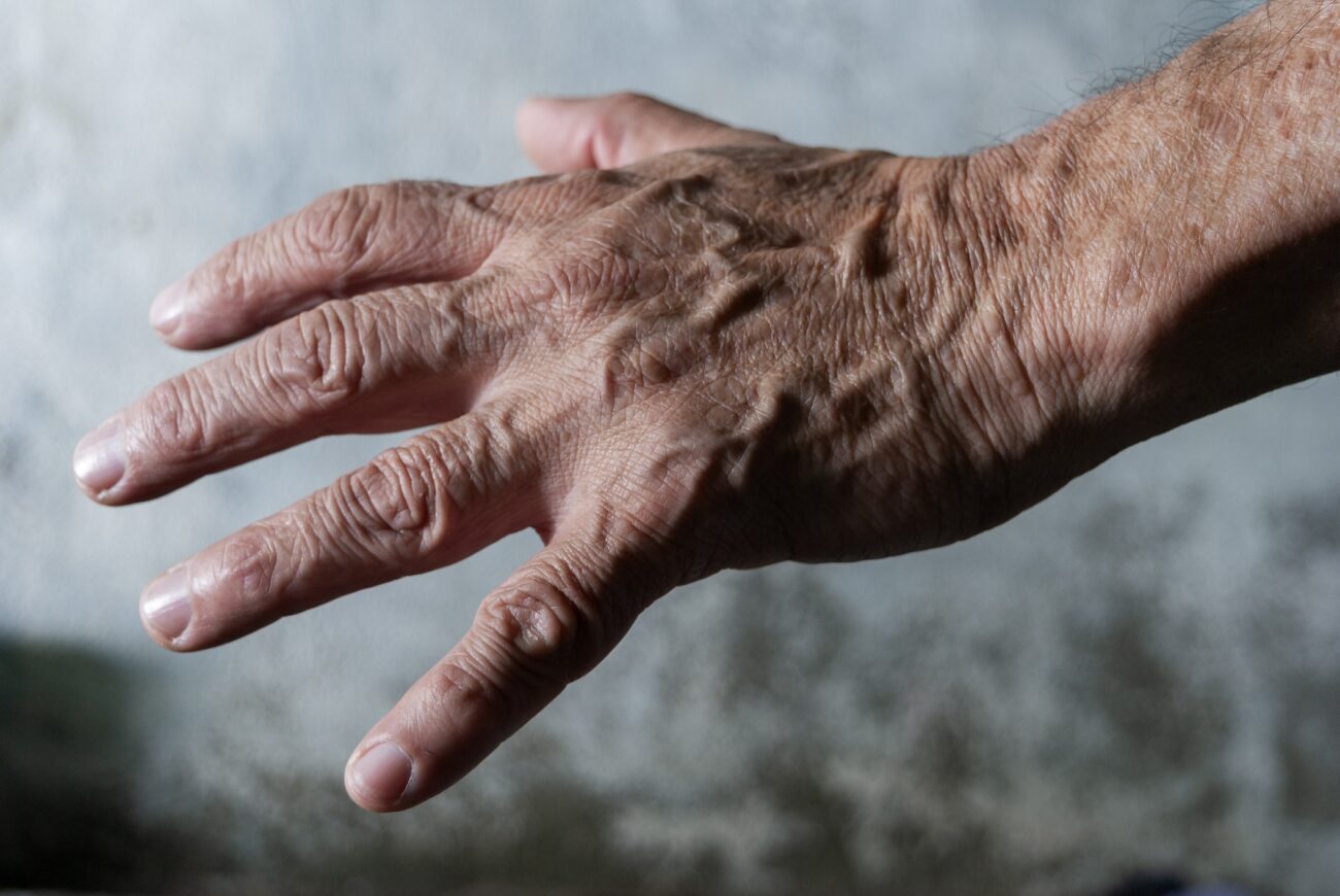 Veines marquées sur les bras