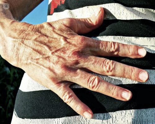 Femme vérifiant ses veines