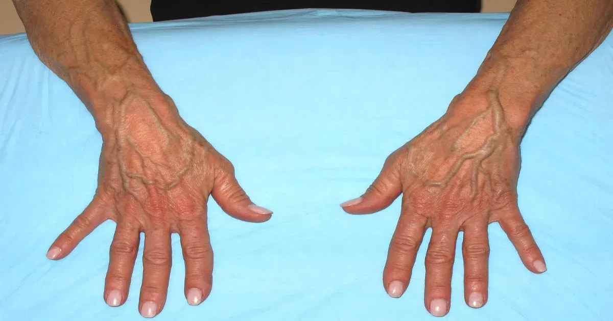 Mains avec veines saillantes