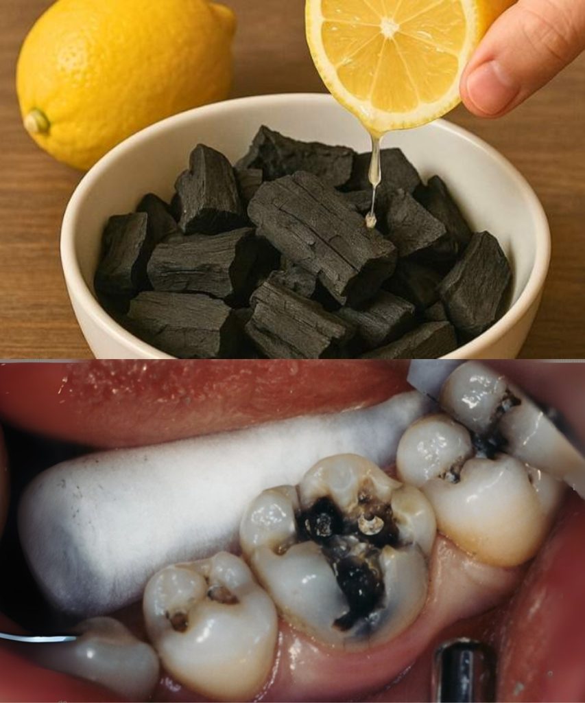 Stimulez la reminéralisation de vos dents des astuces naturelles pour — free download