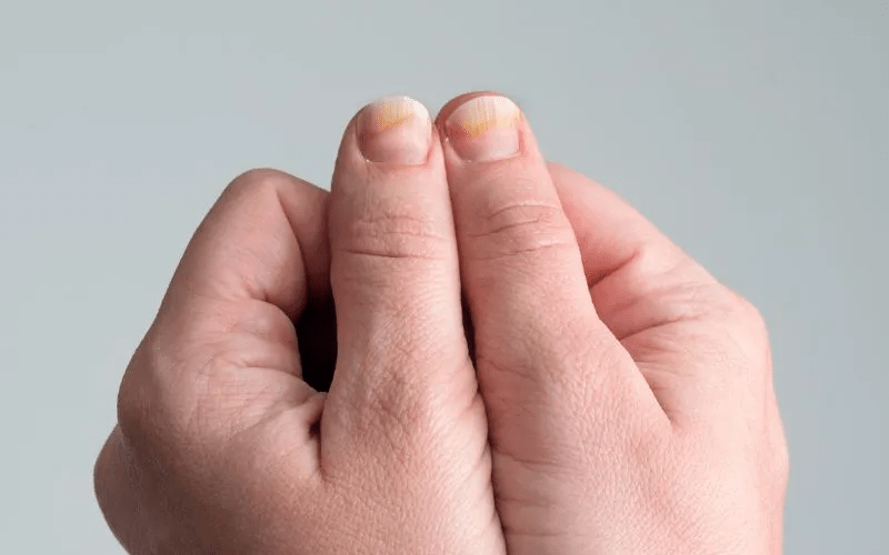 Ongles concaves en forme de cuillère