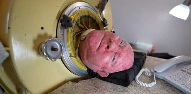 Paul Alexander dans son poumon d'acier